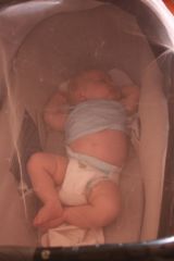 Sous la moustiquaire